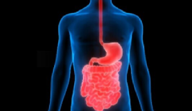 Fig.1 Immagine virtuale 3D dei polmoni e dell’albero bronchiale. In evidenza (rosso) carcinoma del lobo medio del polmone destro.